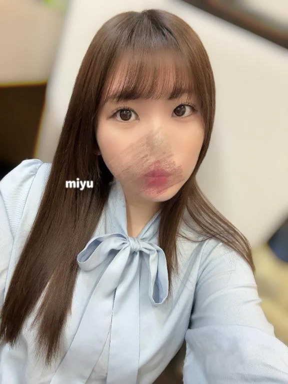 みゆ