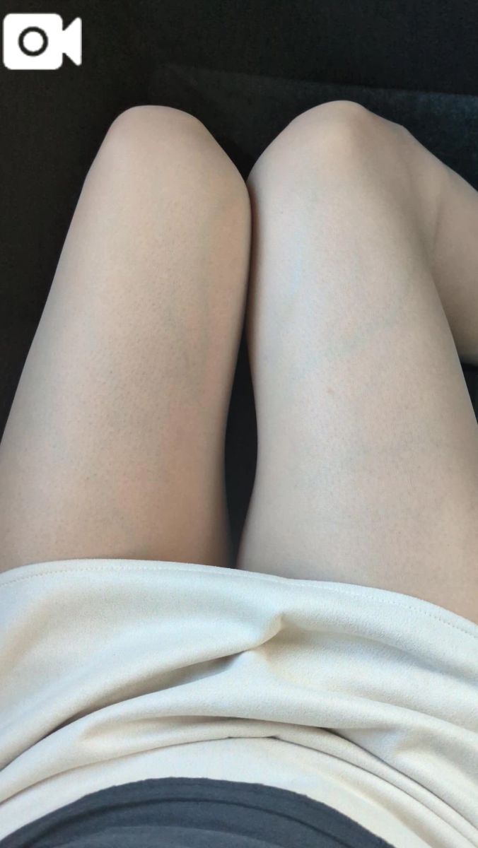 かすみ